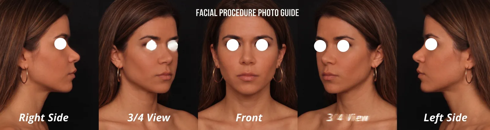 Photo guide showing the five required views — front, both ¾ angles, and both profiles